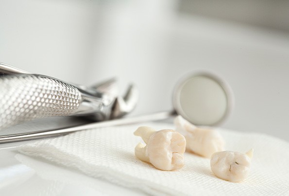 Extracted teeth next to dental instruments